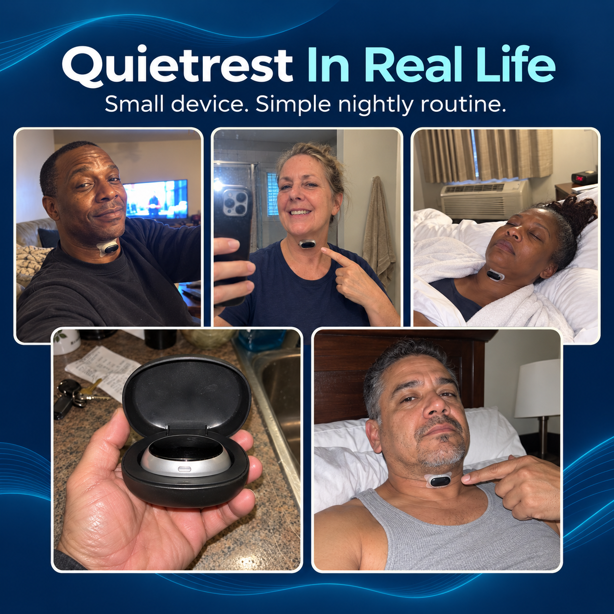 Quietrest Anti-Snoring Device